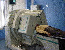 gamma camera