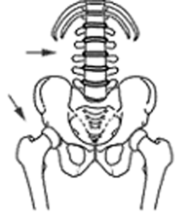 DEXA1