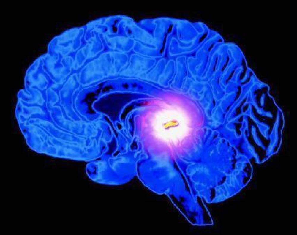 Pineal_Gland